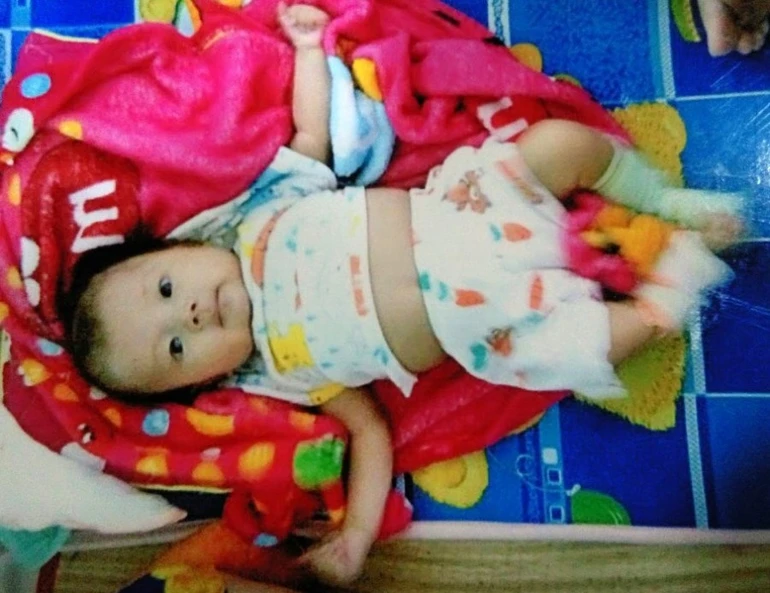 Em bé 1 tuổi bị bệnh hiểm nghèo